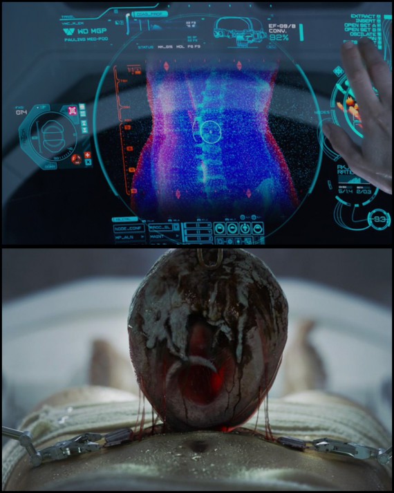 Dr. Shaw diagnosztikai felvétele és kitépett „mája”. <em>Prometheus</em> (Ridley Scott, 2012)